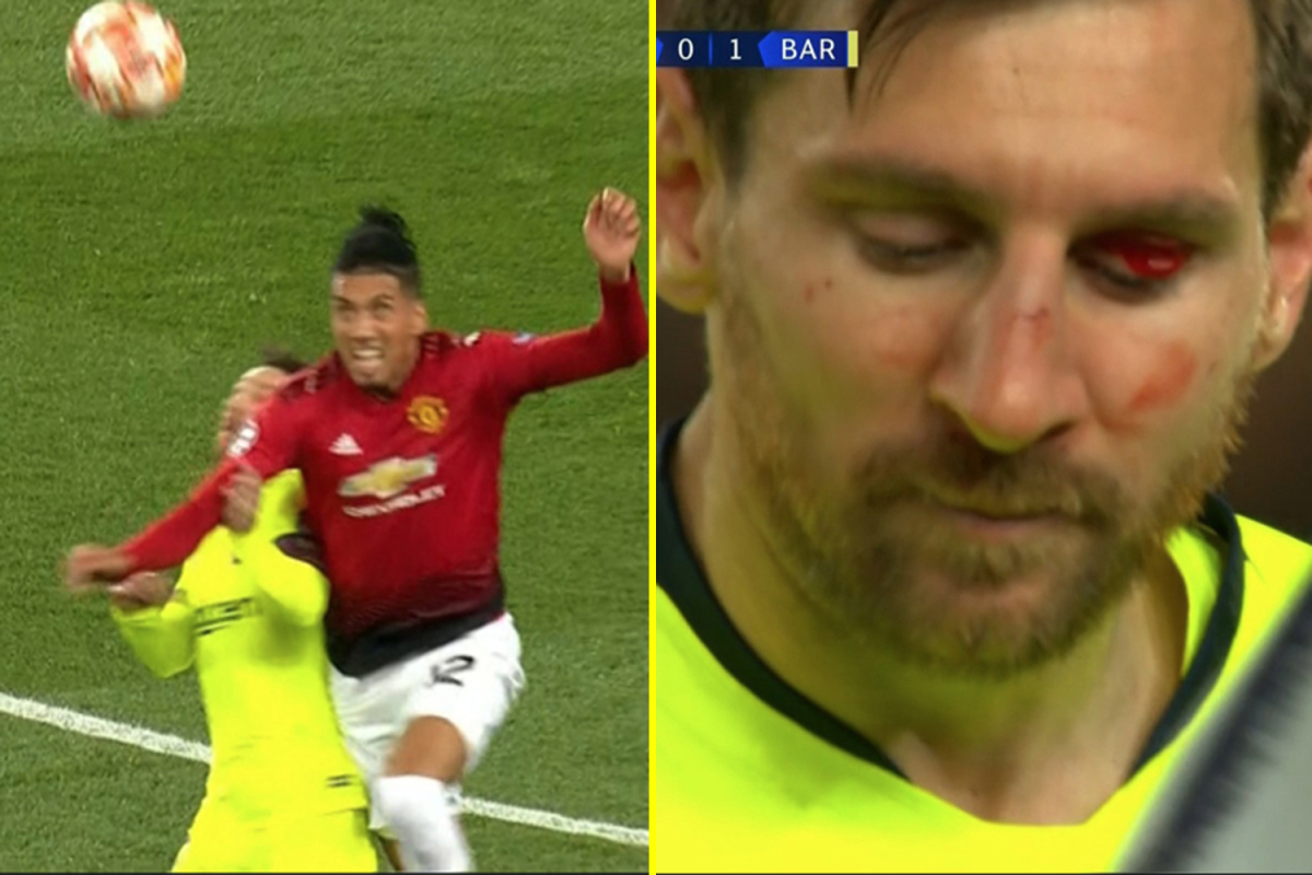Smalling chơi tiểu xảo với Messi MU vs barca, MU 0-1 Barca, tứ kết c1, tứ kết champions league, smalling vs messi, messi chảy máu, smalling, messi
