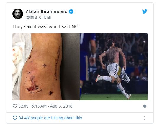Là võ sĩ kiêm cầu thủ, Ibrahimovic mạnh mẽ muốn vượt qua chấn thương zlatan ibrahimovic