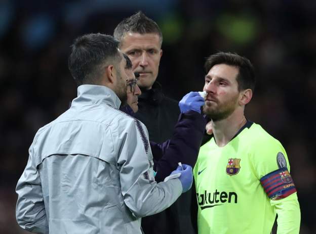 Messi bị chảy máu sau pha va chạm với Smalling tứ kết c1, tu ket c1, tứ kết champions league, mu vs barca, man utd vs barca, mu, man utd, barca, barcelona, messi, smalling