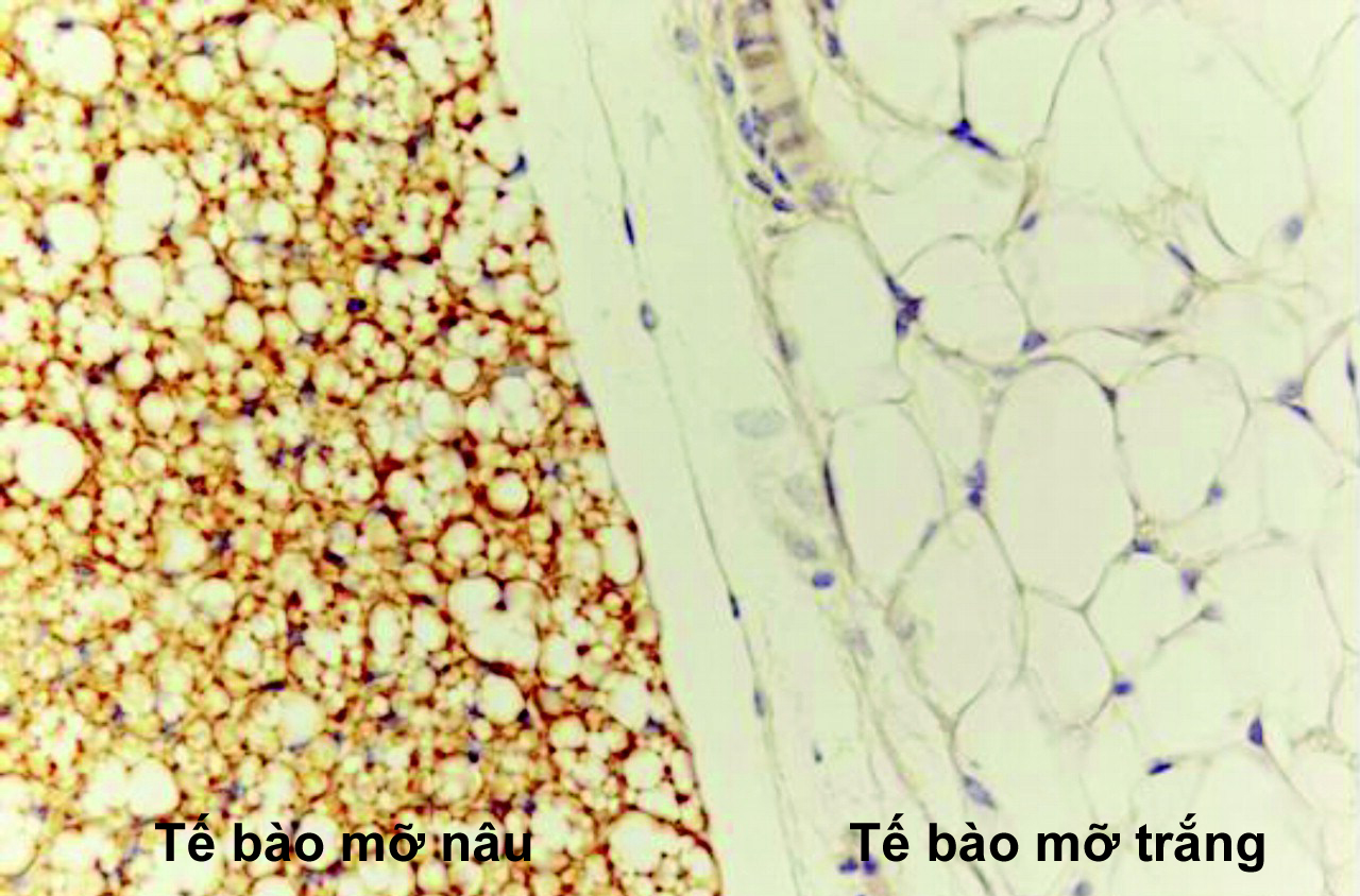 Cơ thể người gồm hai loại mỡ đen và mỡ trắng